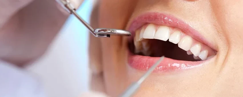 انواع محصولات سفید کننده دندان + علت زردی آن